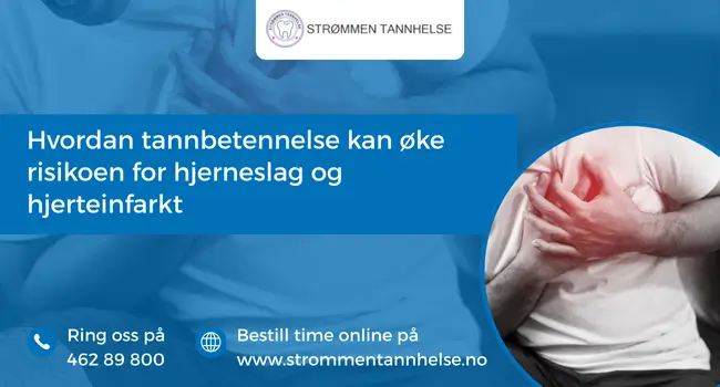 Hvordan tannbetennelse kan øke risikoen for hjerneslag og hjerteinfarkt